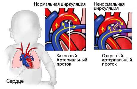 Недавные исследования о заболеваниях сердца