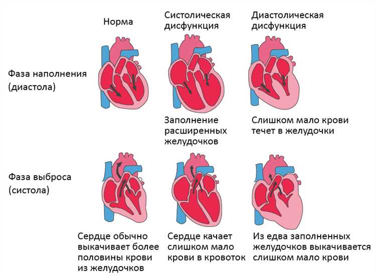 Первые симптомы болезней сердца