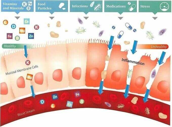 Роль пищевых аллергенов в развитии аутоиммунных заболеваний