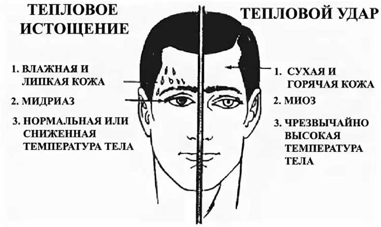 Понимание причин и симптомов теплового истощения