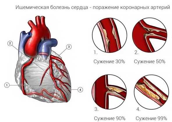 5. Врожденные пороки сердца