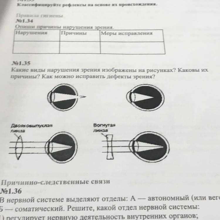 Ошибки рефракции глаза